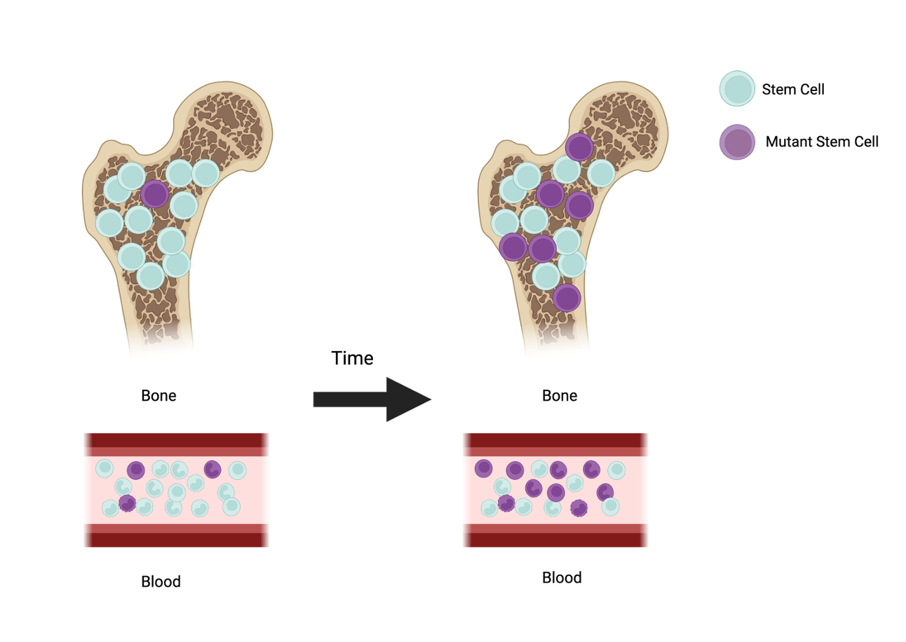 Diagram showing a mutant stem cell in bone marrow expanding over time and increasing mutant cells circulating in the blood